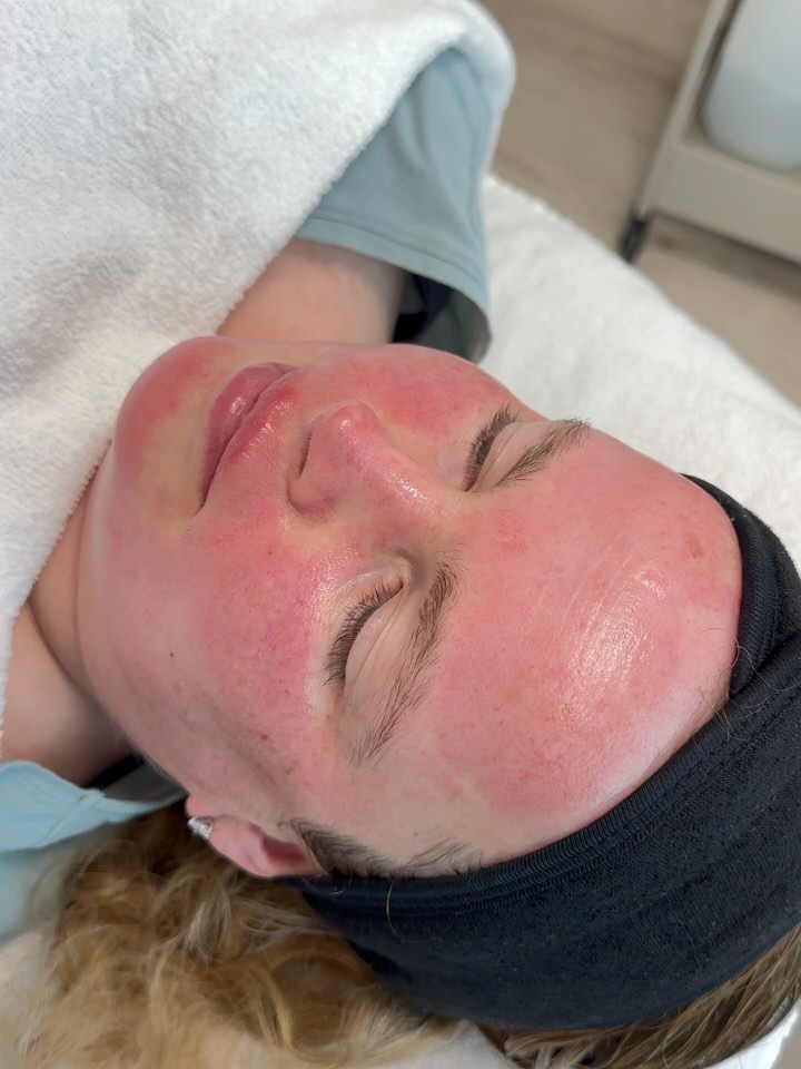 Gezichtsbehandeling in actie