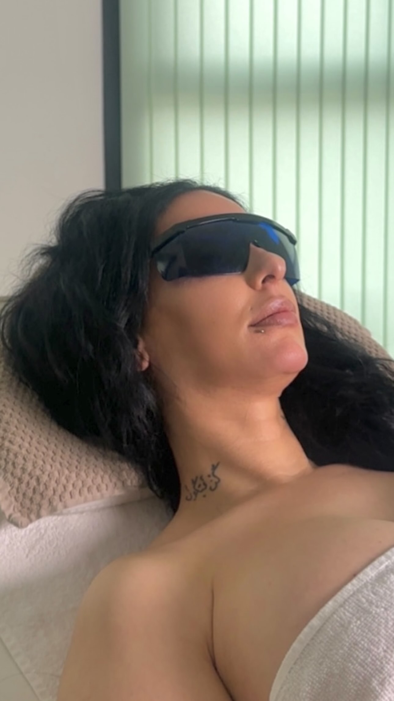 Laserbehandeling met veiligheidsbril